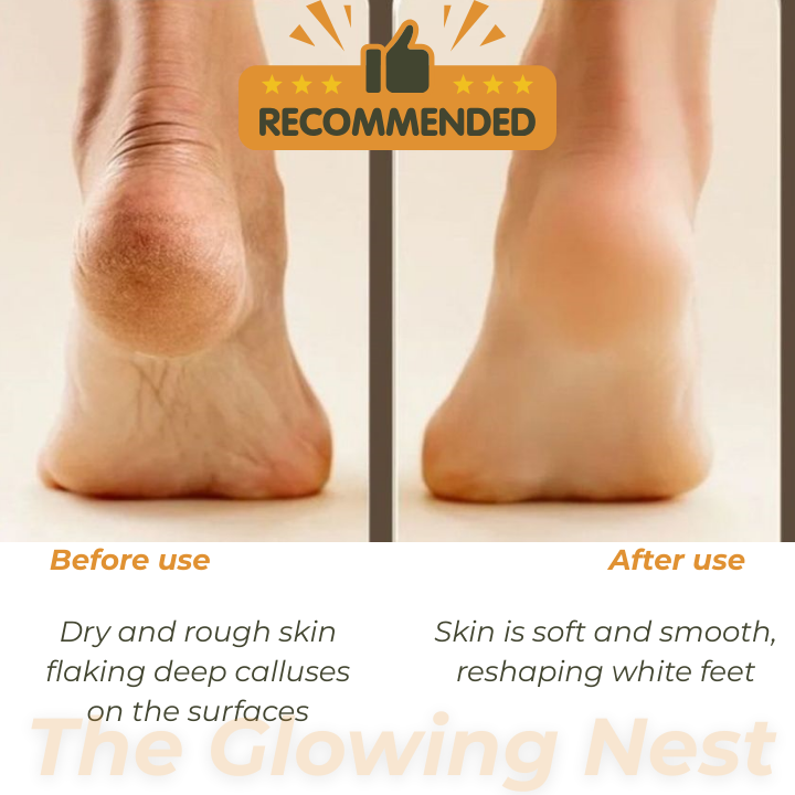 Electric Soft Heel Calus Remover