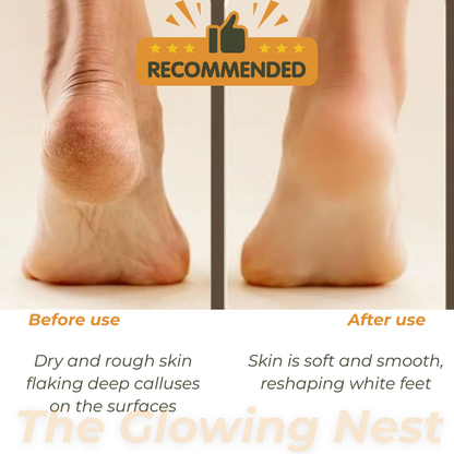Electric Soft Heel Calus Remover