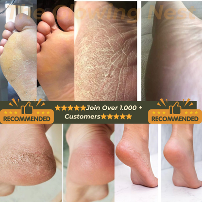 Electric Soft Heel Calus Remover